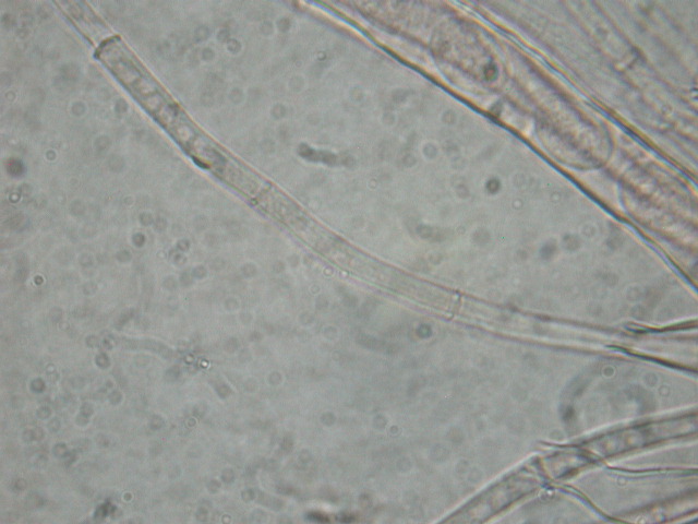 Geopora sumneriana ... in MICRO